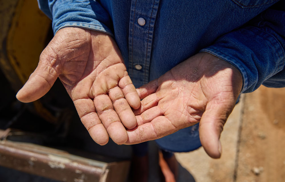 Close-up of a person’s open hands showing worn, calloused palms, wearing a denim work shirt, standing outdoors at a construction site.